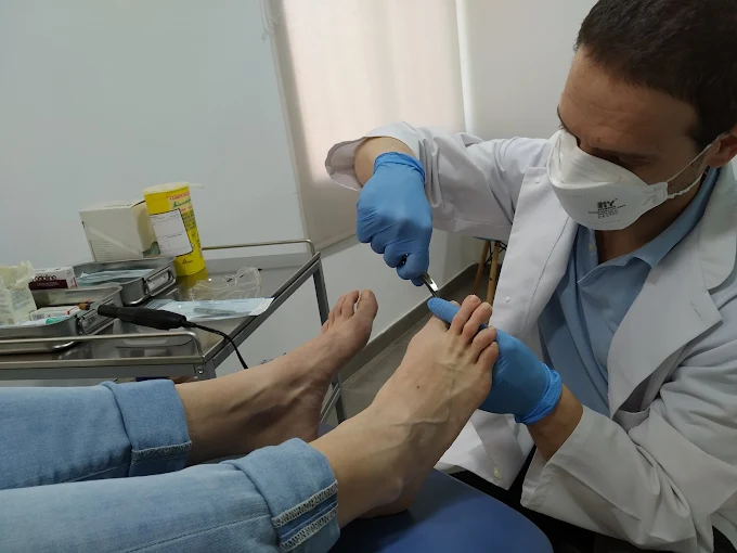 Consulta de Quiropodología en Móstoles